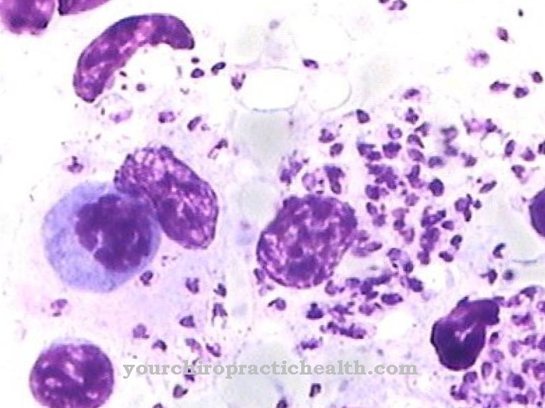 Leishmania