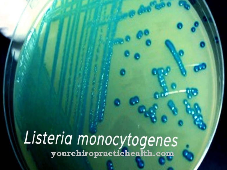 Listeria monocytogenes