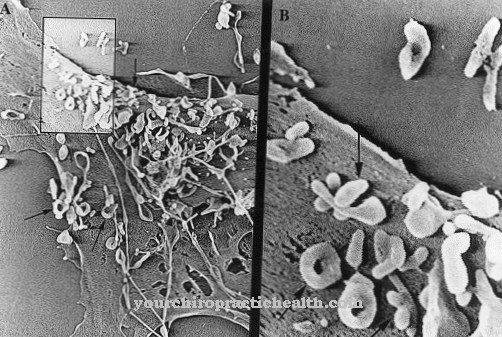 Mycoplasma fermentans