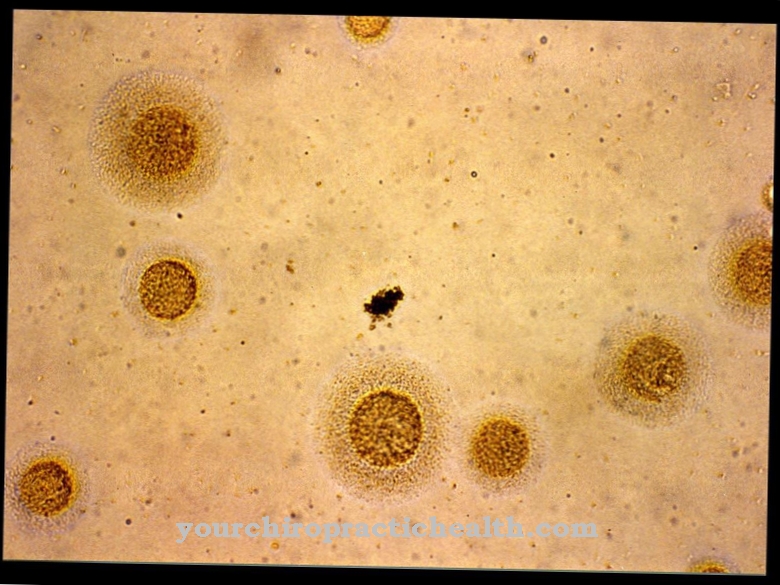 Mycoplasma hominis