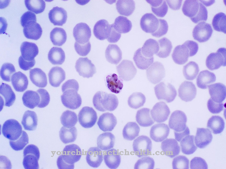 Plasmodium malariae