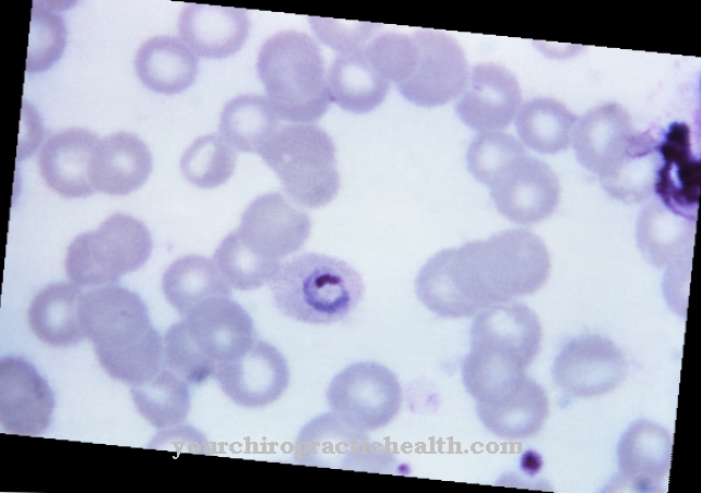 Plasmodium ovale