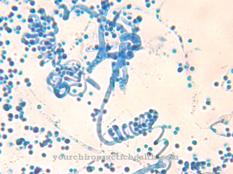 Trichophyton mentagrophytes