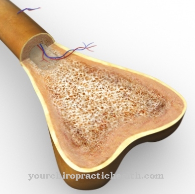 Appositional ossification