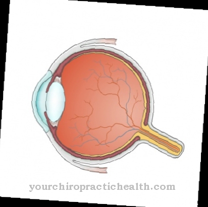 Choroidal neovascularization