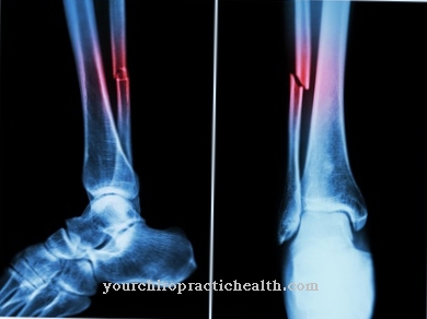 Inflammatory phase