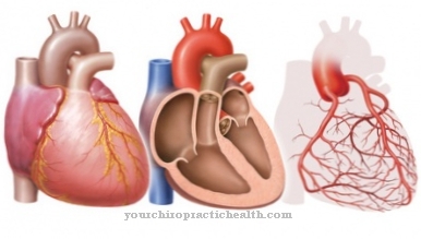 Coronary vascular resistance