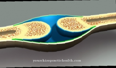 Perichondral ossification