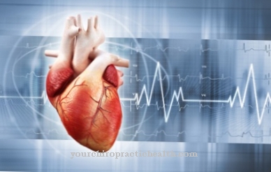 Sinus rhythm