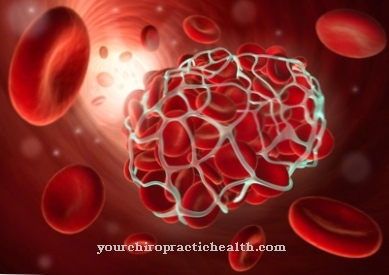 Thrombus formation