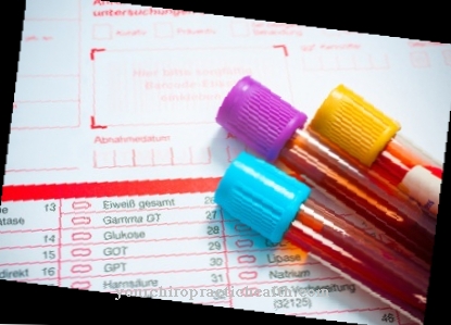 Blood sugar levels