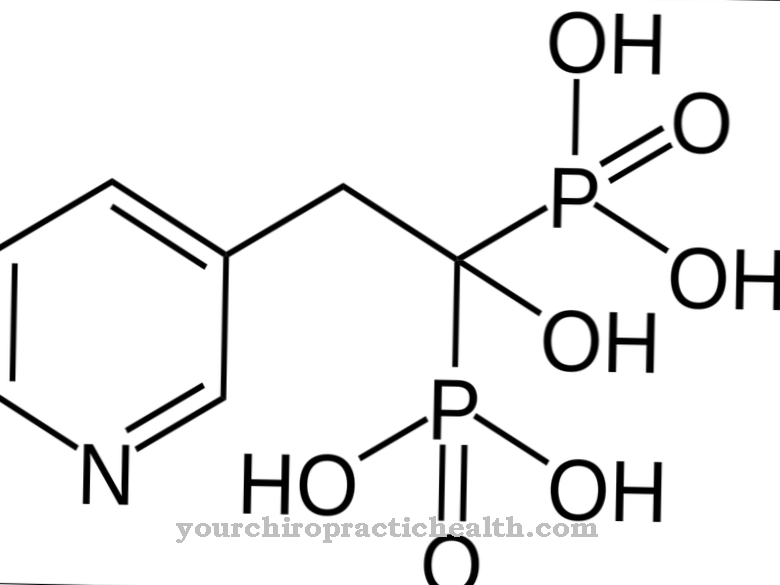 Hidroksiapatit