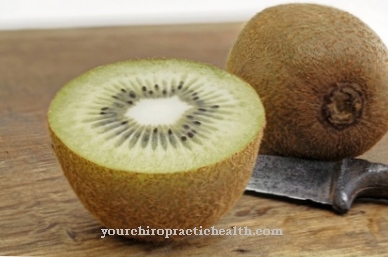 Kiwi fruit