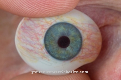 Prosthetic eye