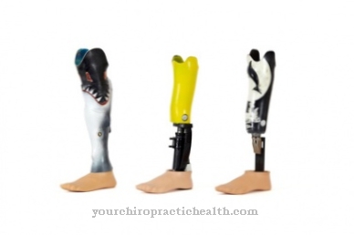 Prosthetic leg