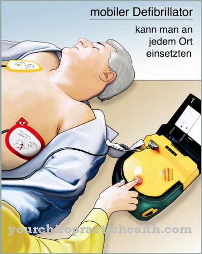 Defibrillator