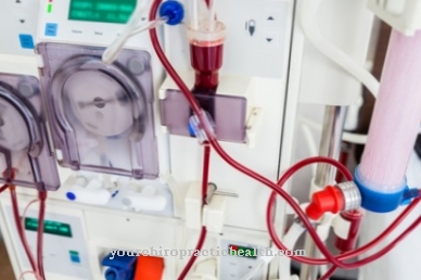 Dialysis machine