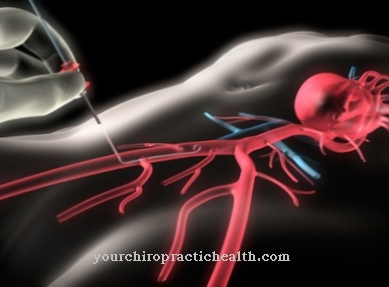 Cardiac catheter