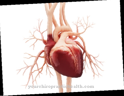 Heart valve replacement