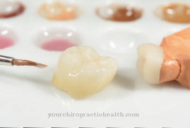 Artificial tooth crown