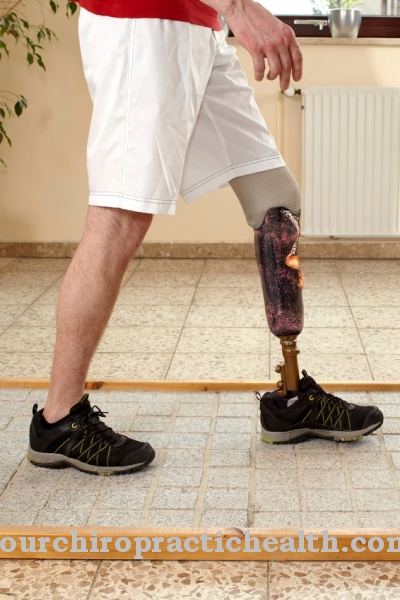 prosthesis