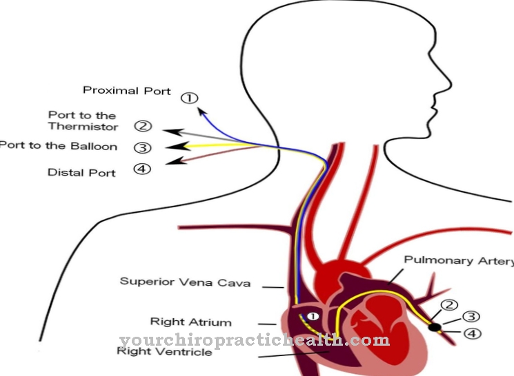 Swan-Ganz catheter