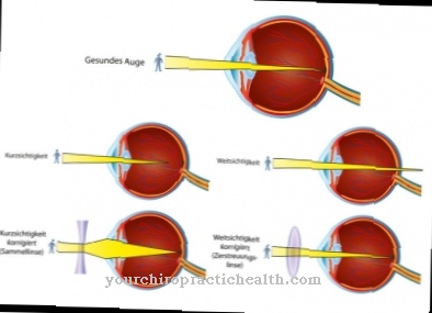 Enfermedades oculares: cuando los ojos sufren