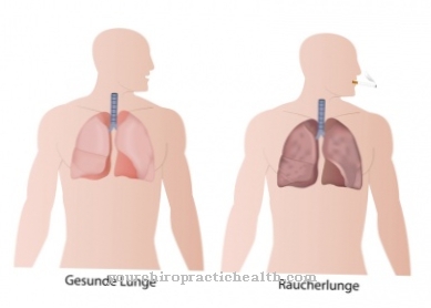 Varenicline for smoking cessation