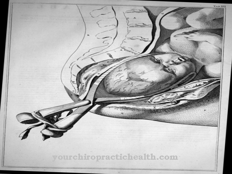 Penghantaran forceps