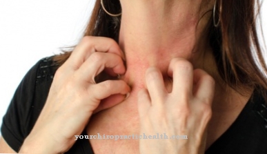 Rash on the neck