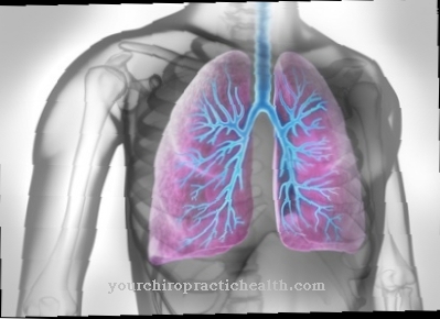 Pulmonary bleeding