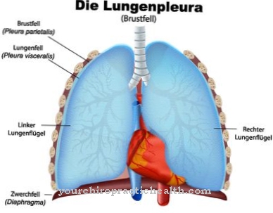 Pleural effusion