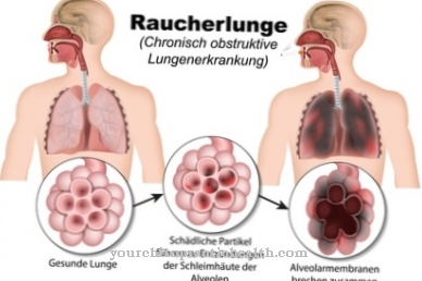 Smoker's cough