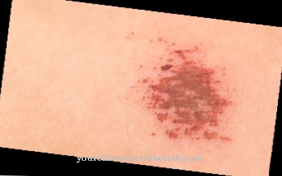 Scab (exudate)