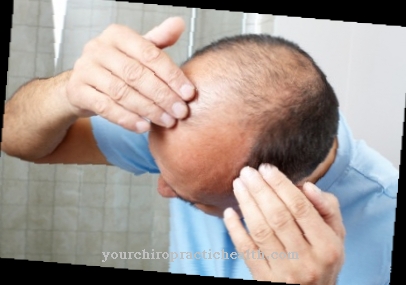 minoxidil