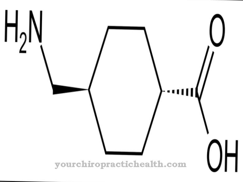 Tranexamic acid